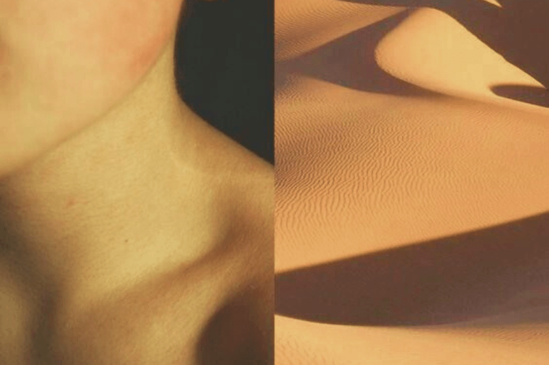 Piel chinita, ¿A ti qué te eriza la&nbsp;piel?